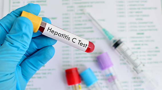 Are you following the most recent guidelines for Hepatitis C Virus screening?